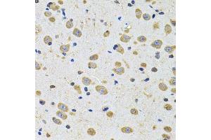 Immunohistochemistry of paraffin-embedded rat brain using EPHA2 Antibody. (EPH Receptor A2 抗体  (AA 847-976))