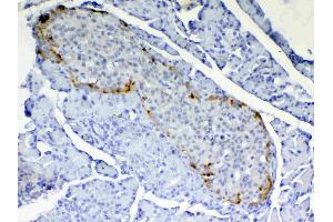 IHC analysis of RBP4 using anti-RBP4 antibody .