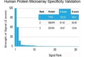 Analysis of HuProt(TM) microarray containing more than 19,000 full-length human proteins using recombinant TP53 antibody (clone rBP53-12). (p53 抗体  (N-Term))