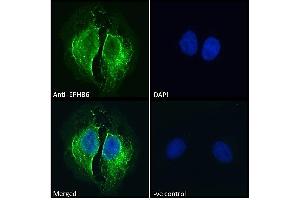 ABIN7013872 Immunofluorescence analysis of paraformaldehyde fixed U2OS cells, permeabilized with 0. (EPH Receptor B6 抗体  (Internal Region))