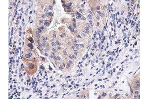 Image no. 10 for anti-COBW Domain Containing 1 (CBWD1) antibody (ABIN1497117) (CBWD1 抗体)