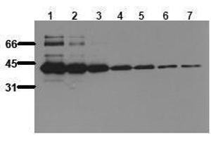 Western Blotting (WB) image for anti-MBP Tag antibody (ABIN126834)