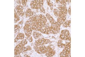 anti-Eukaryotic Translation Initiation Factor 3 Subunit A (EIF3A) (AA 860-910) antibody