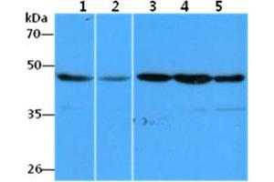 The Cell lysates (40ug) were resolved by SDS-PAGE, transferred to PVDF membrane and probed with anti-human EEF1A1 antibody (1:1000). (eEF1A1 抗体)