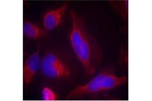 Image no. 2 for anti-Fms-Related tyrosine Kinase 3 (FLT3) (AA 589-593) antibody (ABIN401557) (FLT3 抗体  (AA 589-593))