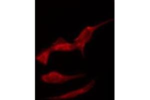ABIN6275337 staining Hela by IF/ICC. (SLC6A15 抗体  (N-Term))