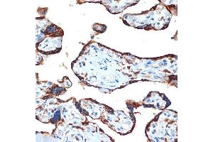 Immunohistochemistry of paraffin-embedded human placenta using NAIP Rabbit mAb (ABIN7268931) at dilution of 1:100 (40x lens). (NAIP 抗体)