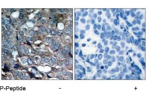 Image no. 1 for anti-Mitogen-Activated Protein Kinase Kinase Kinase 5 (MAP3K5) (pSer83) antibody (ABIN196913) (ASK1 抗体  (pSer83))
