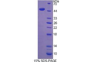 Image no. 1 for Sclerostin (SOST) (AA 25-213) protein (His tag,GST tag) (ABIN4989594)
