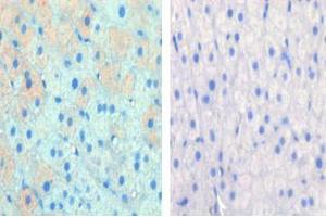 Left image is paraformaldehyde-fixed and paraffin-embedded cow lactating with CPT1A Pab , which was peroxidase-conjugated to the secondary antibody, followed by AEC staining, right image is contrast, did not add the antibody.