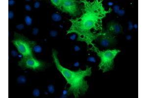Anti-ERBB2 mouse monoclonal antibody (ABIN2454964) immunofluorescent staining of COS7 cells transiently transfected by pCMV6-ENTRY ERBB2 (RC212583). (ErbB2/Her2 抗体  (AA 676-1255))