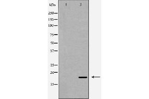 Western blot analysis of Caspase 6 (Cleaved-Asp179) expression in Hela cells. (Caspase 6 抗体  (Cleaved-Asp179))