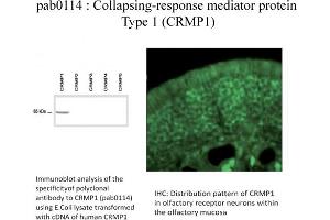 Image no. 1 for anti-Collapsin Response Mediator Protein 1 (CRMP1) (C-Term) antibody (ABIN347035) (CRMP1 抗体  (C-Term))