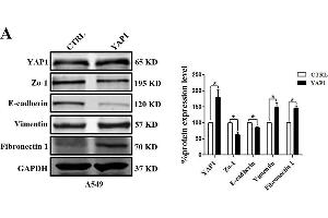 EMT-related marker expression in A549 cells with YAP1 overexpression or silencing. (GAPDH 抗体)