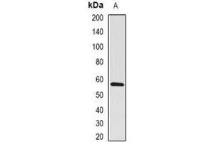 Western Blotting (WB) image for anti-Bone Morphogenetic Protein Receptor, Type IB (BMPR1B) antibody (ABIN7307574)