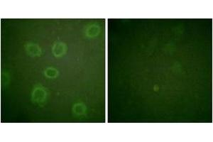 Immunofluorescence analysis of HuvEc cells, using HER2 (Phospho-Thr686) Antibody. (ErbB2/Her2 抗体  (pThr686))
