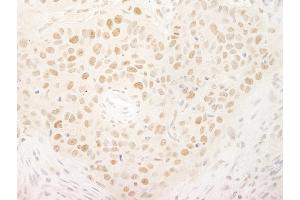 anti-Kinesin Family Member C1 (KIFC1) (AA 1-50) antibody