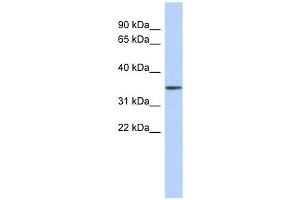 FBXO31 antibody used at 1 ug/ml to detect target protein. (FBXO31 抗体  (Middle Region))