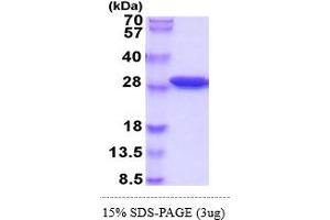 Sepiapterin Reductase (SPR) (AA 1-262) protein (His tag)