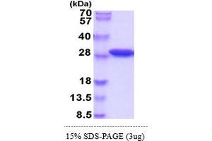 SDS-PAGE (SDS) image for Sepiapterin Reductase (SPR) (AA 1-262) protein (His tag) (ABIN5854975) (SPR Protein (AA 1-262) (His tag))