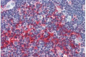Immunohistochemistry (Formalin-fixed Paraffin-embedded Sections) (IHC (fp)) image for anti-Actin, beta (ACTB) (AA 359-368) antibody (ABIN574006)