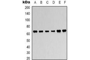 Western blot analysis of AMPK alpha 1 expression in Hela (A), 293T (B), C2C12 (C), NIH3T3 (D), rat heart (E), rat brain (F) whole cell lysates. (PRKAA1 抗体)