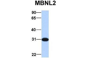 Host:  Rabbit  Target Name:  MBNL2  Sample Type:  Human Fetal Brain  Antibody Dilution:  1. (MBNL2 抗体  (Middle Region))