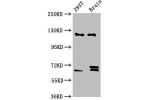 Western Blot Positive WB detected in: 293T whole cell lysate, Rat brain tissue All lanes: TCERG1 antibody at 5. (TCERG1 抗体  (AA 782-896))