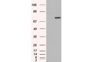 Western Blotting (WB) image for anti-Peptidyl Arginine Deiminase, Type IV (PADI4) (N-Term) antibody (ABIN185308)
