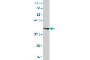 Western Blotting (WB) image for anti-GDP-Mannose Pyrophosphorylase B (GMPPB) (AA 1-110) antibody (ABIN526161)