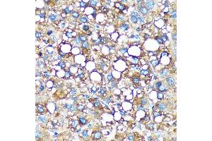 Immunohistochemistry (IHC) image for anti-GEM Interacting Protein (GMIP) (AA 1-91) antibody (ABIN7267369)