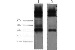 Western Blotting (WB) image for anti-EF-Hand Domain Family, Member D1 (EFHD1) antibody (ABIN5959455)