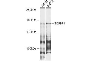 Western blot analysis of extracts of various cell lines, using TOPBP1 antibody (ABIN6134114, ABIN6149397, ABIN6149400 and ABIN6216254) at 1:1000 dilution. (TOPBP1 抗体  (AA 1-100))