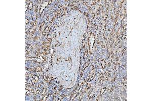 IHC analysis of PTRF/CAVIN1 using anti-PTRF/CAVIN1 antibody (ABIN7601817). (PTRF 抗体  (AA 47-390))