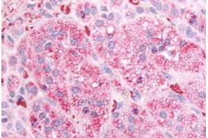 Human Adrenal (formalin-fixed, paraffin-embedded) stained with GPR84 antibody ABIN213440 at 10 ug/ml followed by biotinylated goat anti-rabbit IgG secondary antibody ABIN481713, alkaline phosphatase-streptavidin and chromogen. (GPR84 抗体  (Cytoplasmic Domain))