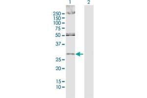 Western Blot analysis of DKK1 expression in transfected 293T cell line by DKK1 MaxPab polyclonal antibody. (DKK1 抗体  (AA 1-266))