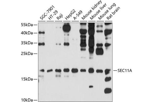 SEC11A anticorps  (AA 37-145)