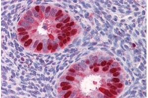 Human Uterus: Formalin-Fixed, Paraffin-Embedded (FFPE) (Deoxyuridine Triphosphatase (DUT) (AA 68-164) 抗体)
