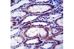 COL1A1 antibody immunohistochemistry analysis in formalin fixed and paraffin embedded human kidney tissue.