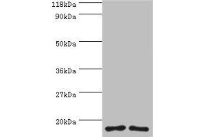 Western blot All lanes: RPS16 protein antibody at 2 μg/mL Lane 1: 293T whole cell lysate Lane 2: EC109 whole cell lysate Secondary Goat polyclonal to rabbit IgG at 1/15000 dilution Predicted band size: 17 kDa Observed band size: 17 kDa (RPS16 抗体  (AA 2-142))