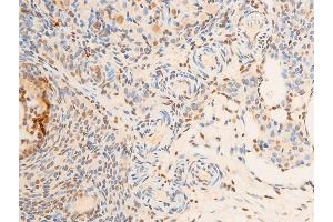 Immunohistochemistry (IHC) image for anti-Neurotrophic Tyrosine Kinase, Receptor, Type 1 (NTRK1) (pTyr681), (Tyr680) antibody (ABIN6256787)