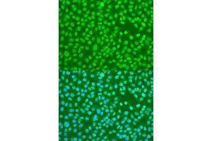 Immunofluorescence analysis of U2OS cells using HNRNPDL antibody (ABIN6127960, ABIN6141907, ABIN6141908 and ABIN6214947) at dilution of 1:100. (HNRPDL 抗体  (AA 261-420))