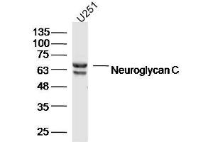 Human U251 cells probed with Neuroglycan C Polyclonal Antibody, unconjugated  at 1:300 overnight at 4°C followed by a conjugated secondary antibody at 1:10000 for 90 minutes at 37°C. (CSPG5 抗体  (AA 351-450))