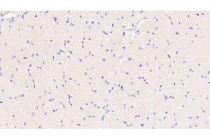 Detection of S100A8 in Bovine Esophagus Tissue using Polyclonal Antibody to S100 Calcium Binding Protein A8 (S100A8) (S100A8 抗体  (AA 1-89))