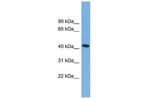 WB Suggested Anti-MAPT  Antibody Titration: 0. (MAPT 抗体  (Middle Region))