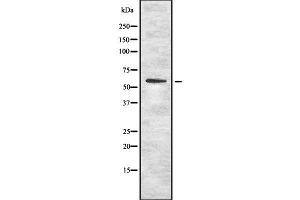 Western blot analysis OCT1 using K562 whole cell lysates (SLC22A1 抗体  (N-Term))