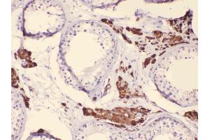 Immunohistochemistry (IHC) image for anti-Cytochrome P450, Family 17, Subfamily A, Polypeptide 1 (CYP17A1) (AA 383-419), (C-Term) antibody (ABIN4886555)