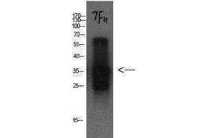Western Blot analysis of Cystatin C protein using CST3 Monoclonal Antibody at dilution of 1:1000. (CST3 抗体)