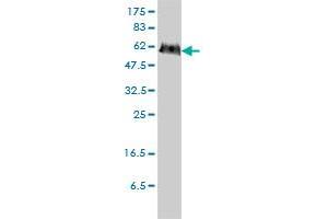 PGM3 monoclonal antibody (M01), clone 1E2-1B12 Western Blot analysis of PGM3 expression in HeLa .