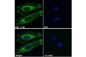 Immunofluorescence (IF) image for anti-Transforming Growth Factor, beta-Induced, 68kDa (TGFBI) (Internal Region) antibody (ABIN571098)